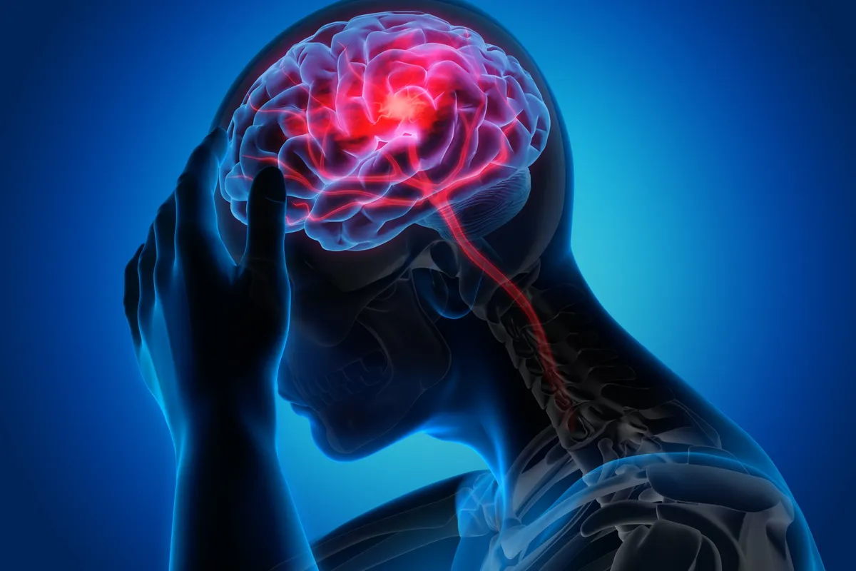 Stroke Improvement with Neurofeedback